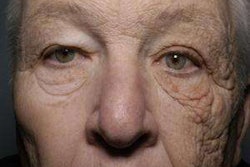 New England Journal Of Medicine Picture