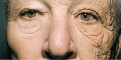 This photo of a 28-year veteran truck driver was published with a medical study about extended exposure to the sun.