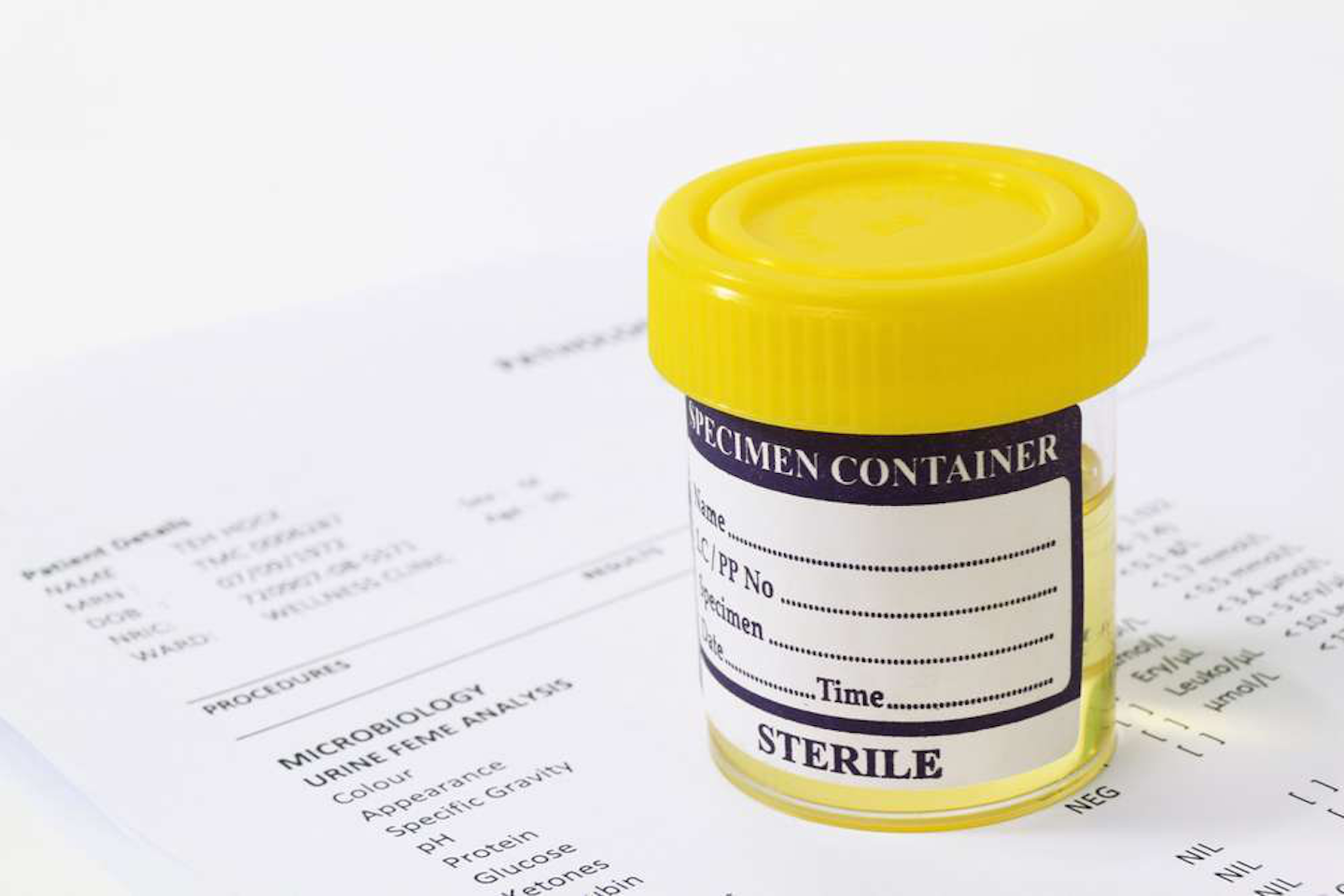 new-cdl-drug-testing-requirements-2022