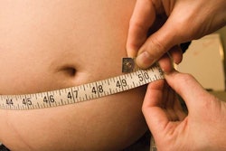 Obese drivers are known to have higher risk of obstructive sleep apnea.