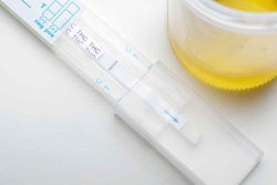 drug test