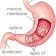 stomach diagram