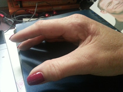 Shark bite, ooh ha-ha!