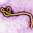 Ebola virus