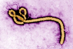 Ebola virus