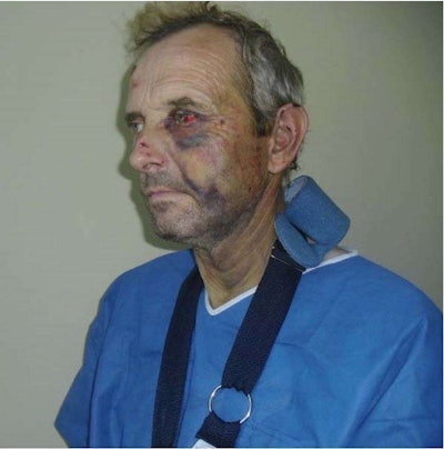 A photo of Kozacenko submitted as evidence in his lawsuit against California.