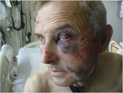 A photo of Kozacenko submitted as evidence in his lawsuit against California.