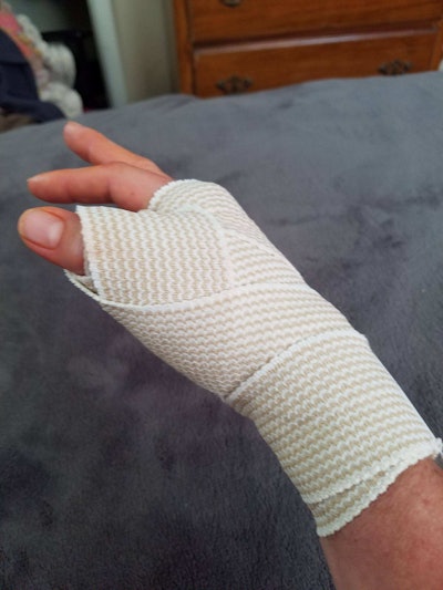 When partners need to help each other recover from surgeries, it’s no small problem to have one hand placed out of service.