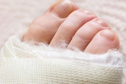 foot-wrapped-in-bandages-with-four-toes-2017-12-08-10-51