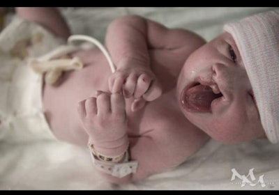 Kayson Buell was born on Thanksgiving Day in 2016 with Trisomy 13, a condition with which he was born with an extra 13th chromosome.