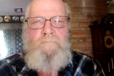 Amos Phillips’ facial wounds have largely healed, but he says he’s still unstable on his feet.