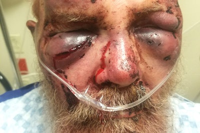 Amos Phillips received head wounds and a brain injury after a man broke into his truck, demanded money and beat him.