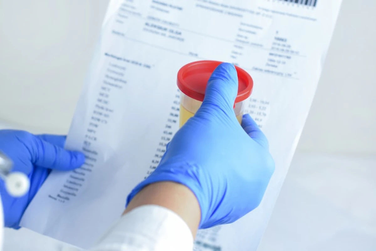 Best way for owner-ops to be notified of a random drug test? - Vimarsana News