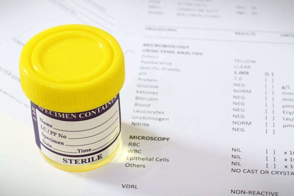 drug urine test specimen bottle